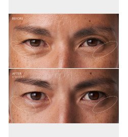 Clé de Peau Beauté Eye Contour Cream Supreme – Luxury Anti-Aging Eye Treatment 15 ml